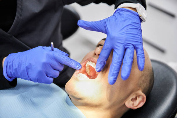 Best Emergency Tooth Extraction in Verandah, FL