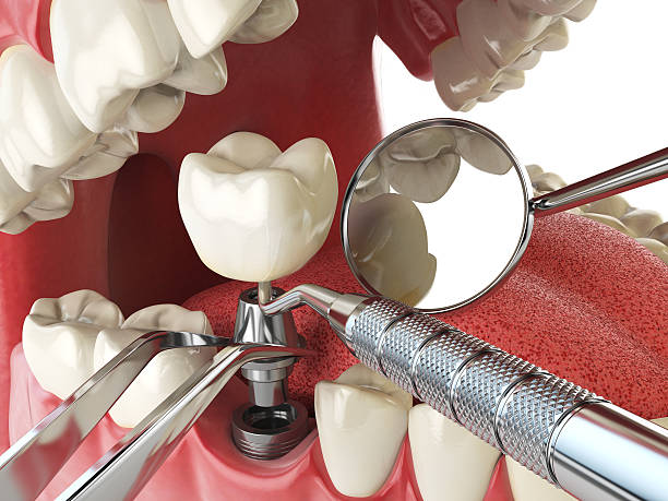  Verandah, FL Emergency Dentist Pros